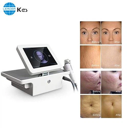 Rf Microneedle Rf Microneedling Machine Салон Използване на преносим фракционен Rf Лифтинг на лице Microneedle Equipo